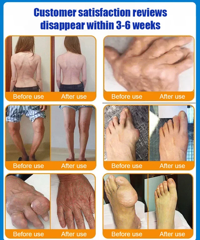 Ganzkörper-Gelenkentlastungs-Gel